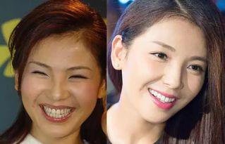 明星雾眉前后对比照片,从模糊到精致，见证美丽蜕变瞬间